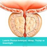 Lazerle Prostat Ameliyatı: Holep, Thulep ve Greenlight